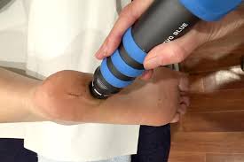 Shockwave therapy, the new miracle treatment
